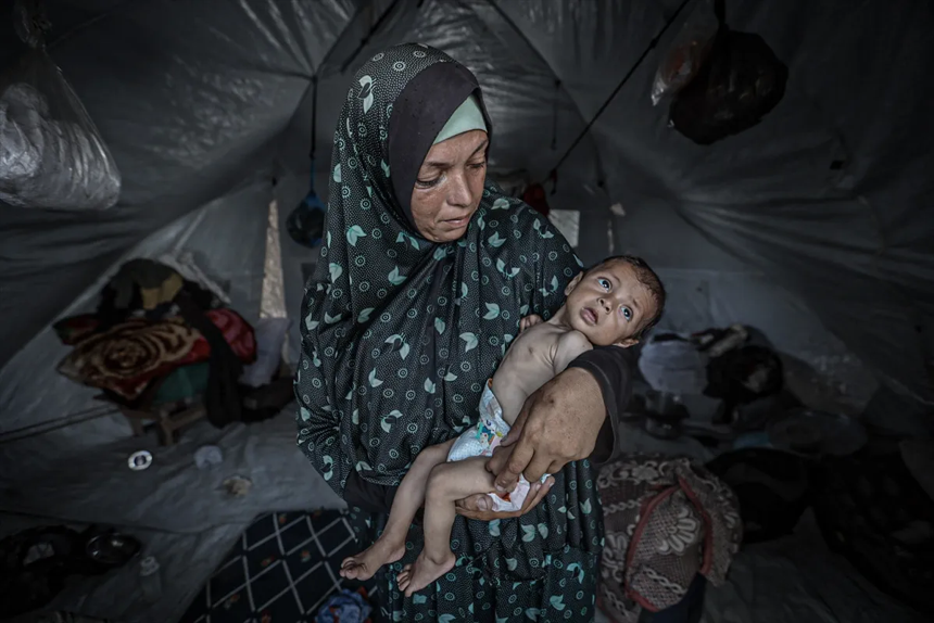 Gazze'de açlıktan ölenlerin sayısı gün geçtikçe artıyor - Resim : 8