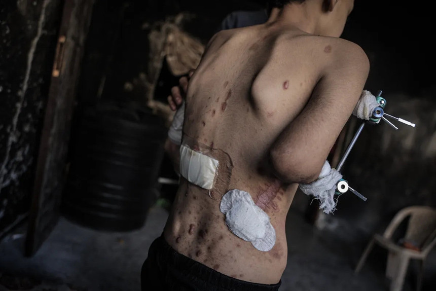 Gazze'de soykırım var! 11 kişi açlıktan hayatını kaybetti - Resim : 5