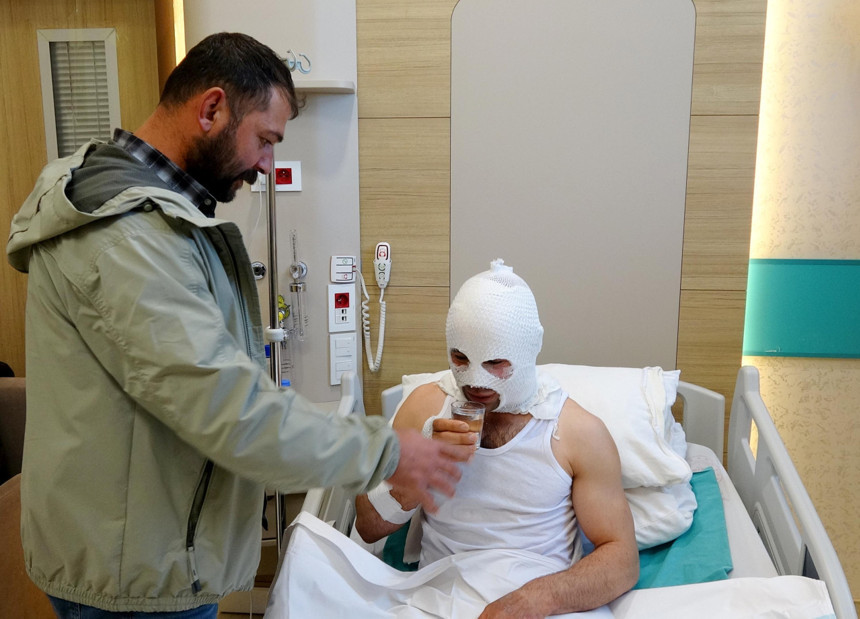 Nişanlısına hediye paketi hazırlarken patlayan sprey boya kutusu hastanelik etti