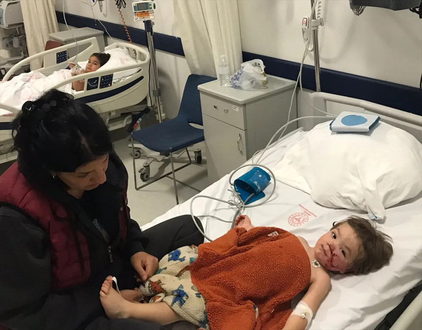 Pitbull cinsi köpeğin saldırısına uğrayan çocuğun yüzü paramparça oldu