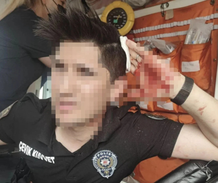 Ankara'da güvenlik güçlerine sopayla saldıran 12 şüpheliye gözaltı - Resim : 3