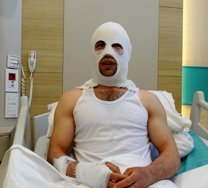 Nişanlısına hediye paketi hazırlarken patlayan sprey boya kutusu hastanelik etti - Resim : 2