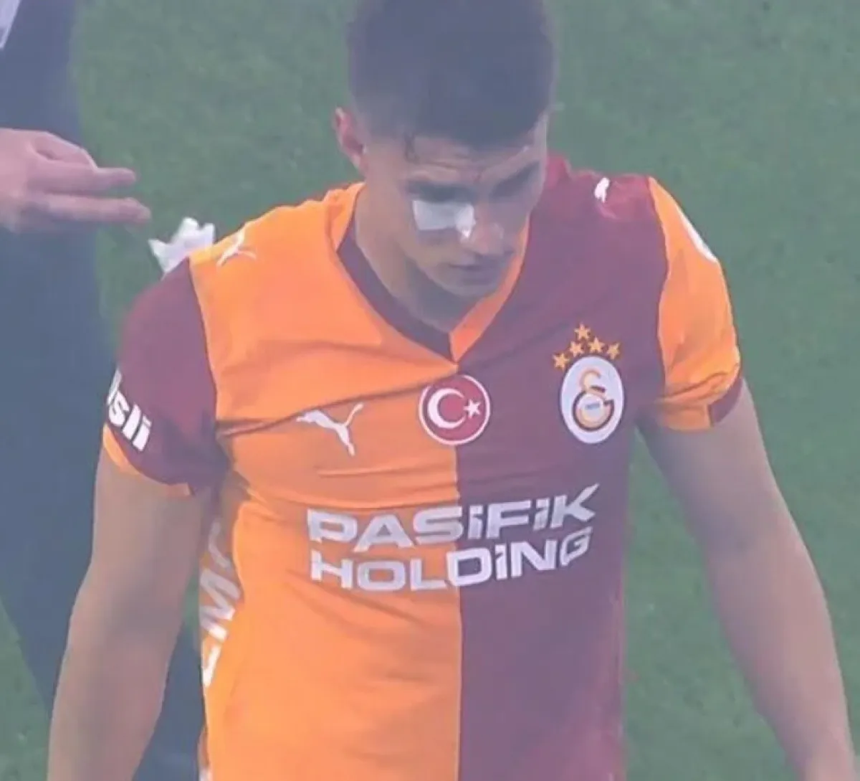 Kazımcan Karataş'a Kadıköy'deki derbide yabancı madde isabet etti - Resim : 2