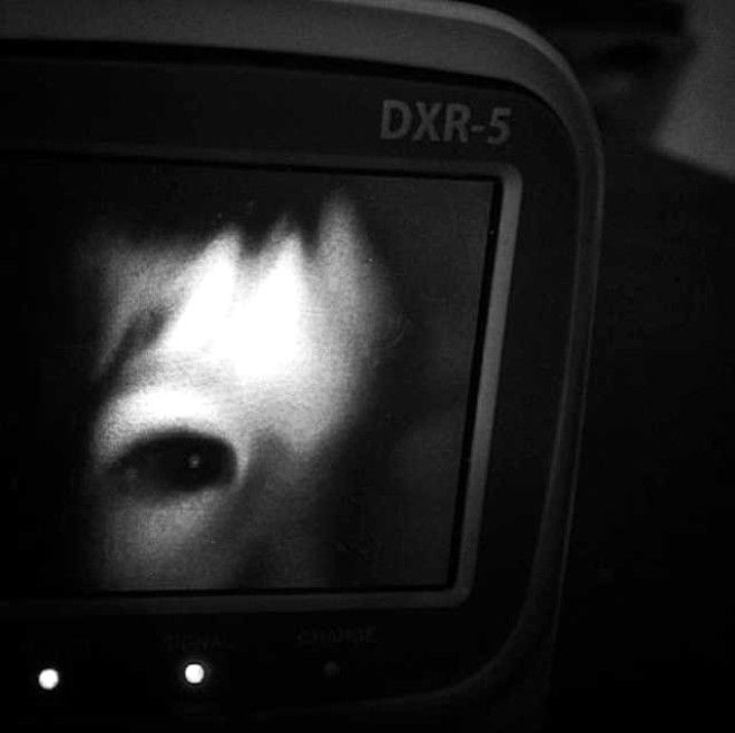 Bu görüntüler bebek kamerasından! - Sayfa 11