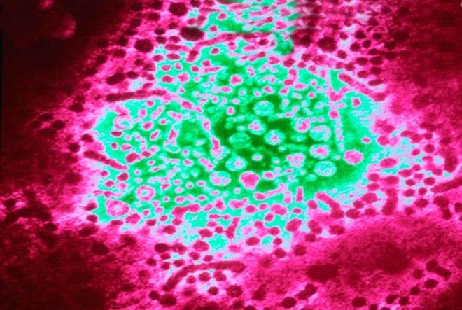 4500 yıllık iskelet tıp tarihini değiştirecek! - Sayfa 6