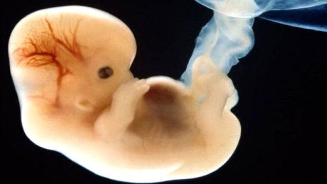 4500 yıllık iskelet tıp tarihini değiştirecek! - Sayfa 8