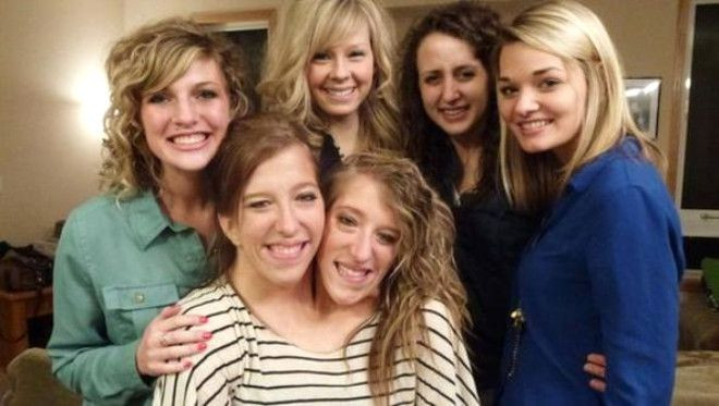 Doktorlar 'Yaşayamaz' demişti,  27 yaşındalar! - Sayfa 5