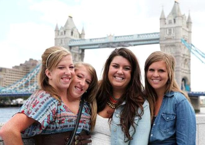 Doktorlar 'Yaşayamaz' demişti,  27 yaşındalar! - Sayfa 11