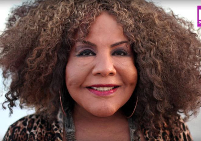 Sahte doktor yüzüne çimento enjekte etti! - Sayfa 6