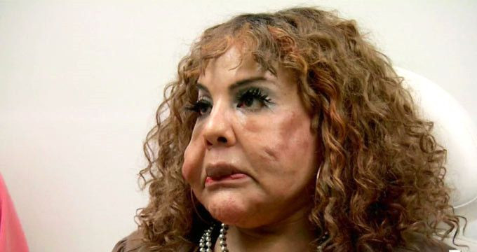 Sahte doktor yüzüne çimento enjekte etti! - Sayfa 7