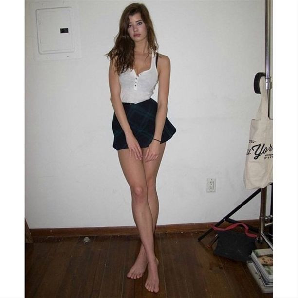 Genetik bozukluğu sayesinde fenomen oldu! - Sayfa 7