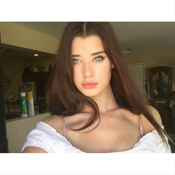 Genetik bozukluğu sayesinde fenomen oldu! - Sayfa 9