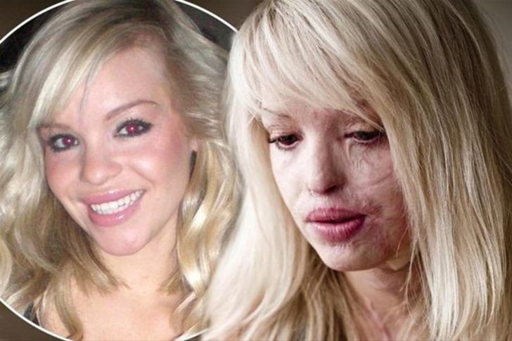 250 operasyon geçirdi ama umudunu kaybetmedi... - Sayfa 5