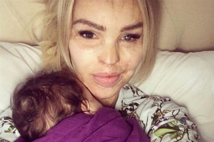 250 operasyon geçirdi ama umudunu kaybetmedi... - Sayfa 19