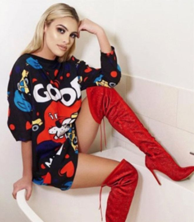 Ünlü fenomenin değişimi ağızları açık bıraktı! - Sayfa 12