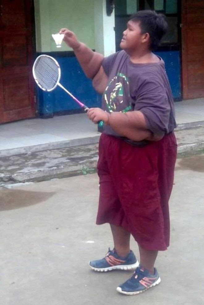 Dünyanın en şişman çocuğu 83 kilo verince... - Sayfa 8