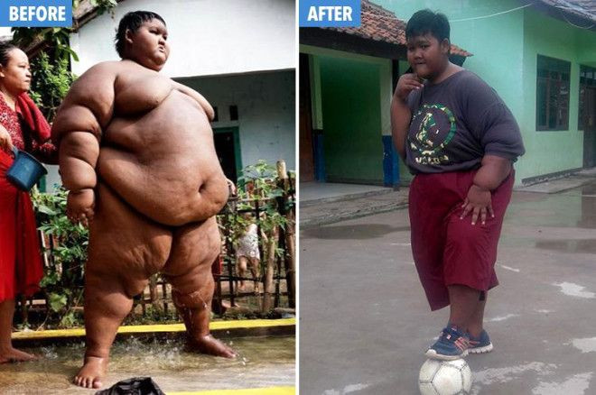 Dünyanın en şişman çocuğu 83 kilo verince... - Sayfa 11