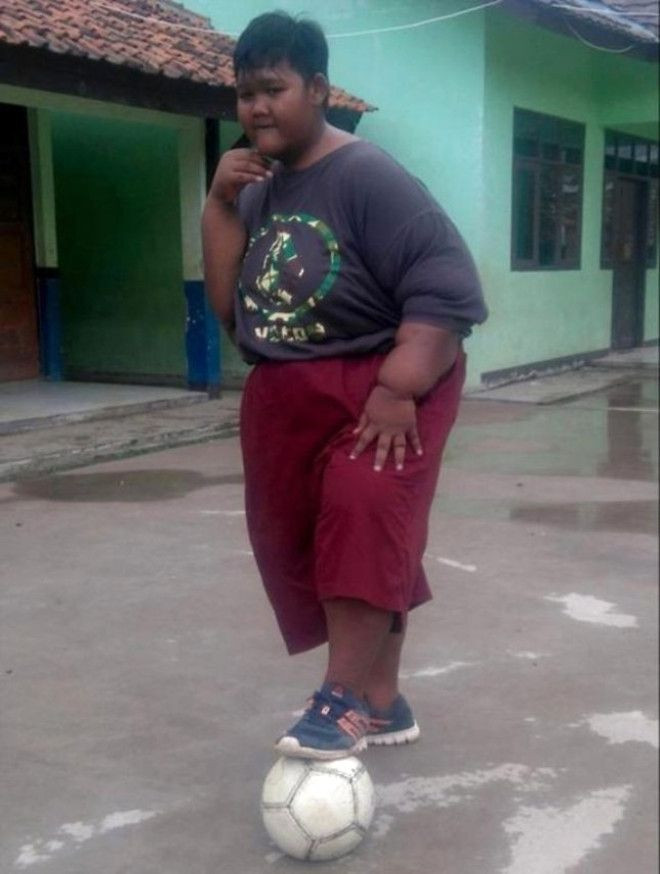 Dünyanın en şişman çocuğu 83 kilo verince... - Sayfa 5