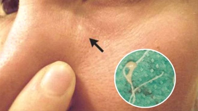 Yüzündeki şişliklerin içinden bakın ne çıktı! - Sayfa 6