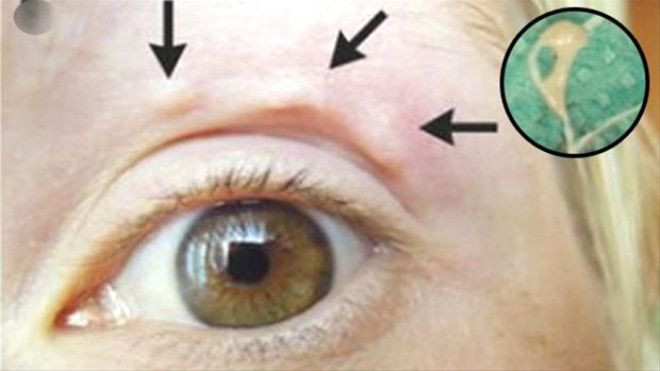 Yüzündeki şişliklerin içinden bakın ne çıktı! - Sayfa 7