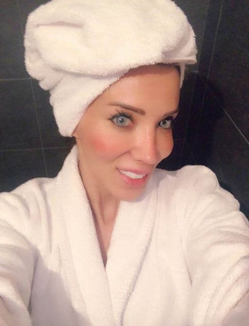 Ciciş Esra estetik yaptırdı, bambaşka biri oldu! - Sayfa 14