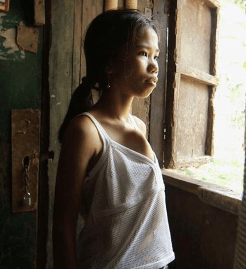 Vücudunda ikizini taşıyor! - Sayfa 5