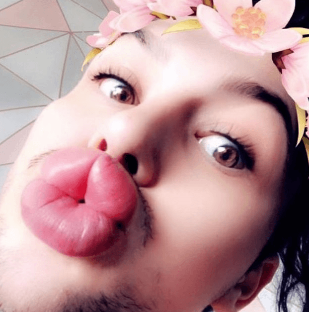 Dudakları patlama noktasına geldi! - Sayfa 8