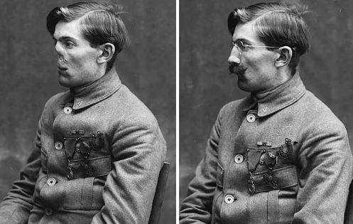 Yüzlerini kaybeden askerleri hayata döndüren kadın! - Sayfa 8