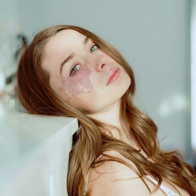 Güzellik standartlarına meydan okuyan modeller! - Sayfa 8