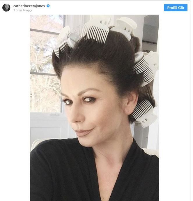 Güzellik uğruna her şeyi yapıyorlar! Sünnet derisi kullanan bile var - Sayfa 11