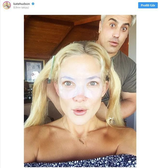 Güzellik uğruna her şeyi yapıyorlar! Sünnet derisi kullanan bile var - Sayfa 12