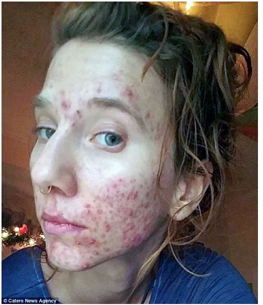 Her gün litrelerce kendi idrarını içiyor! - Sayfa 7