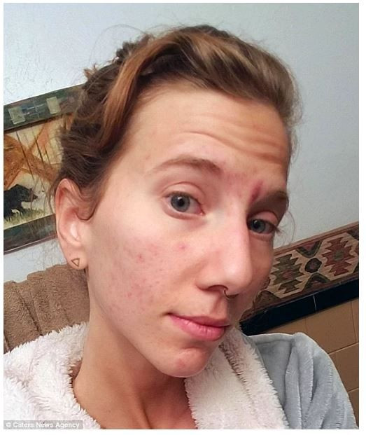 Her gün litrelerce kendi idrarını içiyor! - Sayfa 8