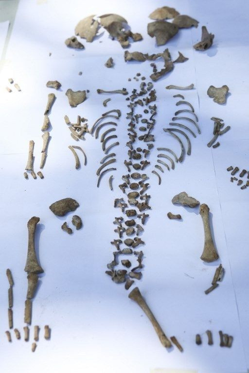 'Dünyanın en şanssız adamı' böyle ölmüş! - Sayfa 9