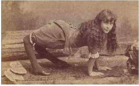 Bu adamın hayatını kurtaran 3'üncü ayağı oldu! - Sayfa 12