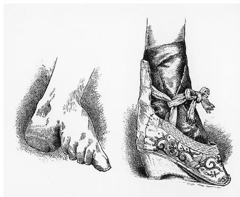 Güzellik uğruna zehir içtiler, bebek düşürdüler! - Sayfa 5