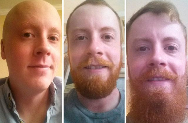 İşte erkeklerin büyük değişiminin sırrı! - Sayfa 10