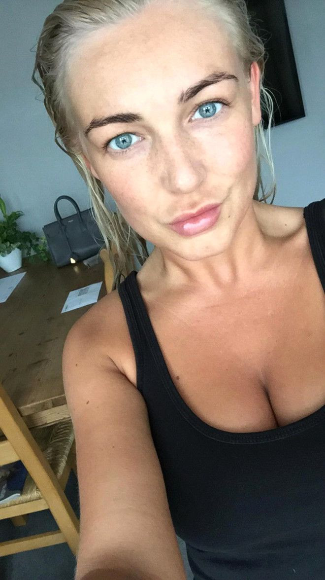 Sivilceleriyle başı dertteydi, son hali inanılmaz! - Sayfa 6