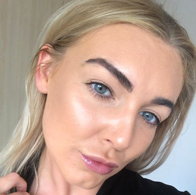 Sivilceleriyle başı dertteydi, son hali inanılmaz! - Sayfa 15