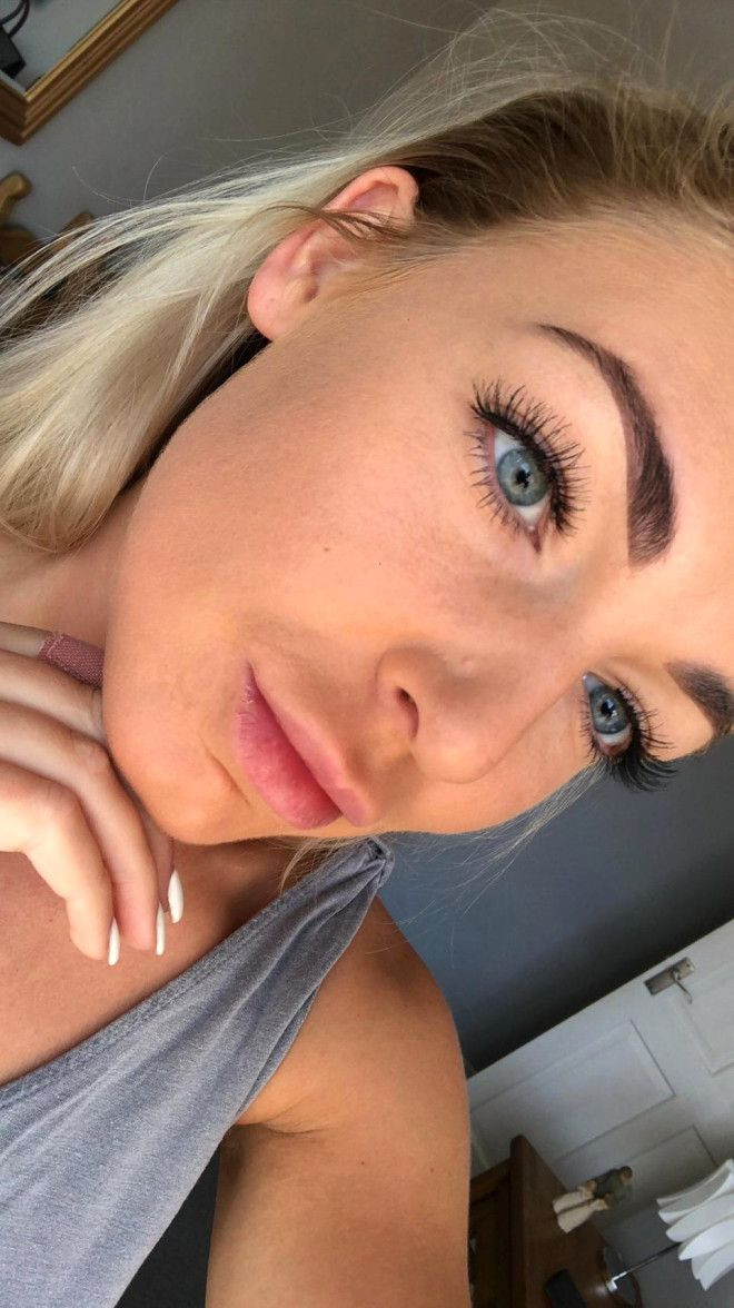 Sivilceleriyle başı dertteydi, son hali inanılmaz! - Sayfa 9