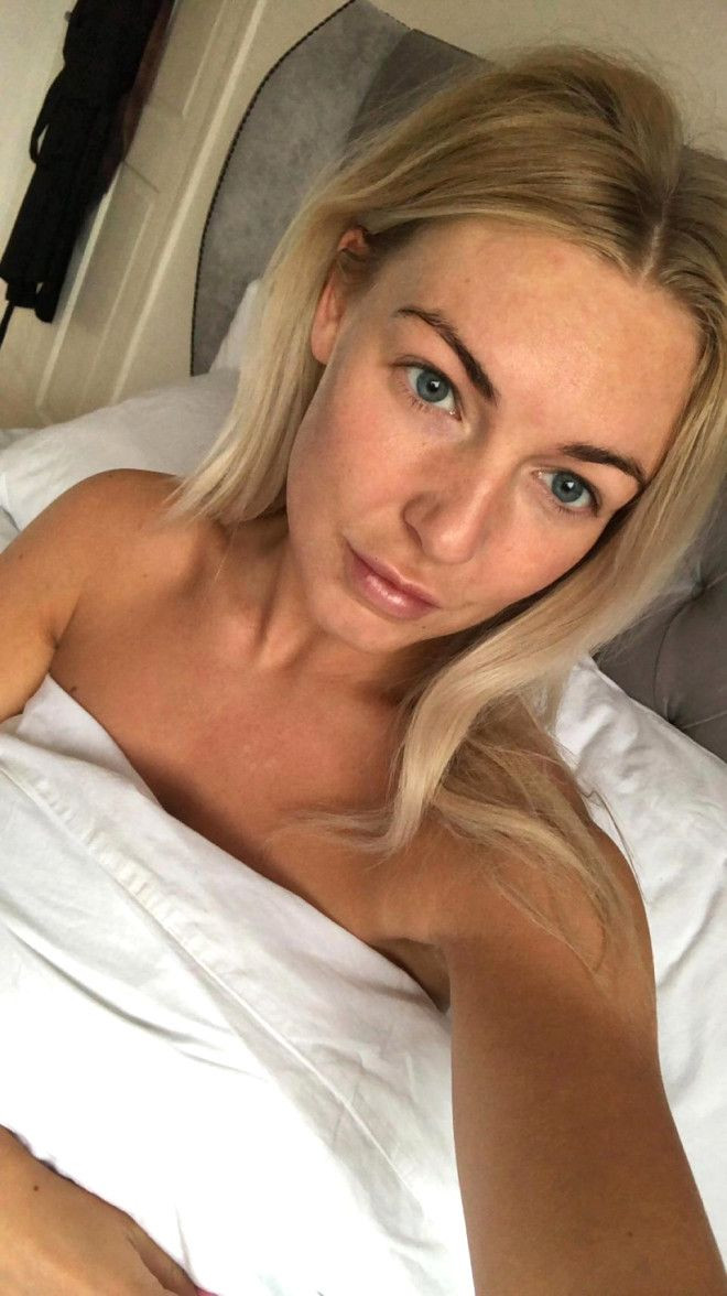 Sivilceleriyle başı dertteydi, son hali inanılmaz! - Sayfa 10