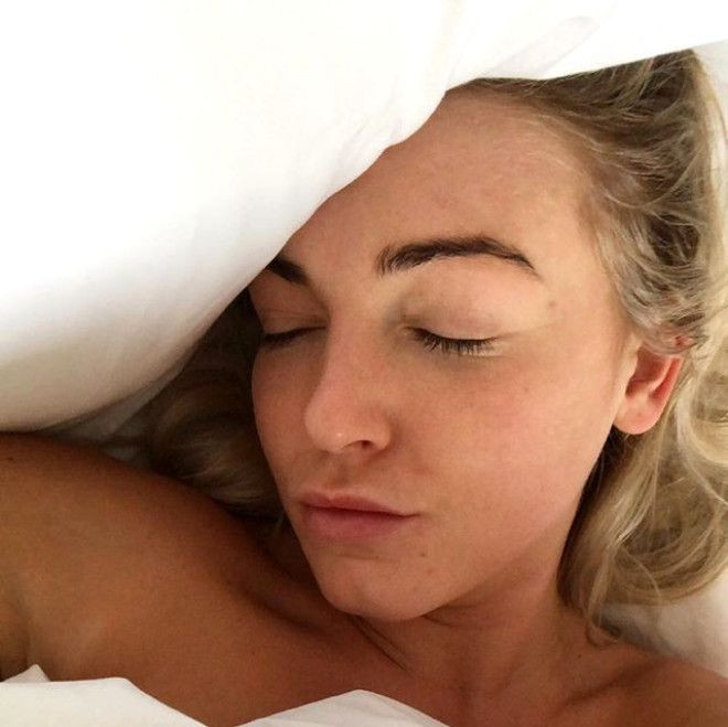 Sivilceleriyle başı dertteydi, son hali inanılmaz! - Sayfa 16