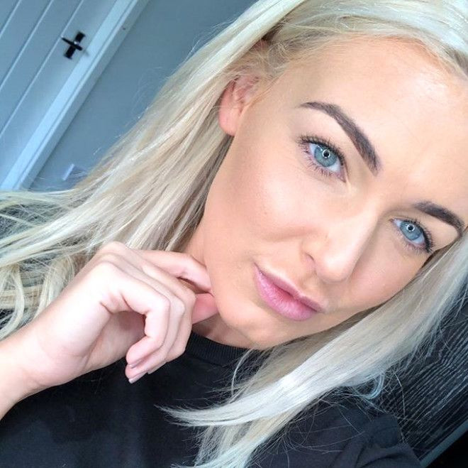 Sivilceleriyle başı dertteydi, son hali inanılmaz! - Sayfa 13