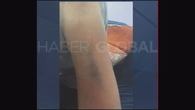 Ahmet Kural'ın aşk dolu bakışları yerini morluklara bıraktı! - Sayfa 7