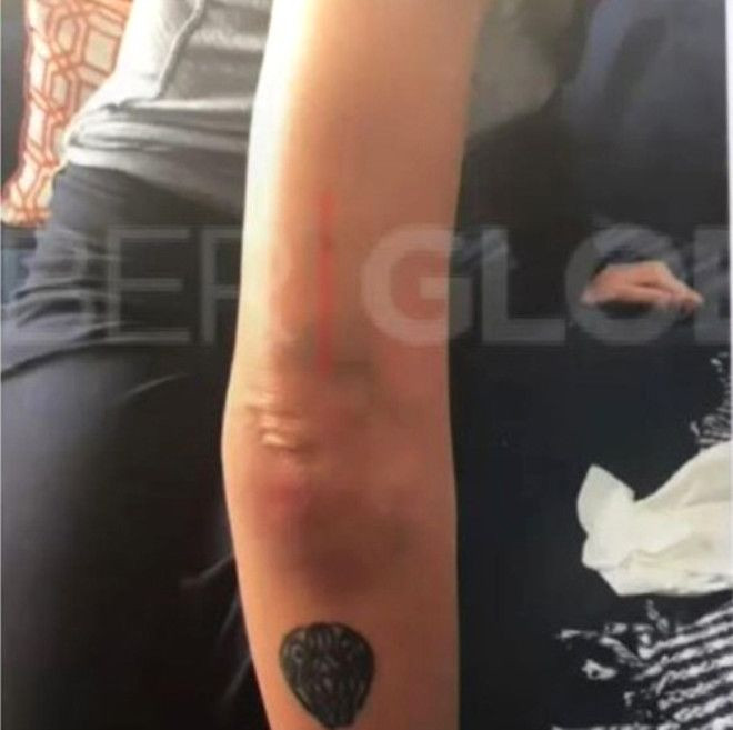 Ahmet Kural'ın aşk dolu bakışları yerini morluklara bıraktı! - Sayfa 6