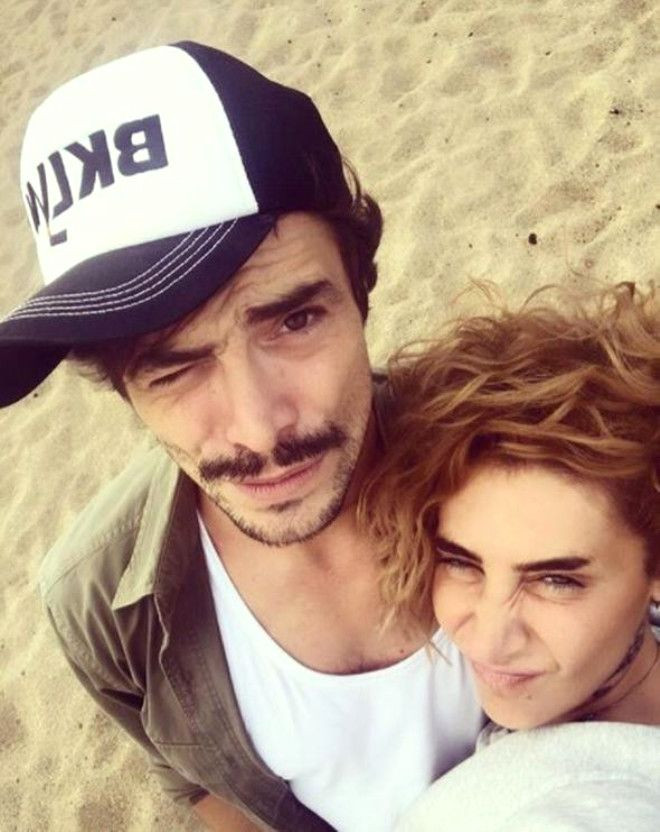 Ahmet Kural'ın aşk dolu bakışları yerini morluklara bıraktı! - Sayfa 5