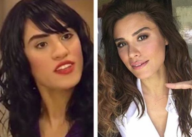 Yıllar önceki fotoğraflarını görenler tanıyamıyor! - Sayfa 20