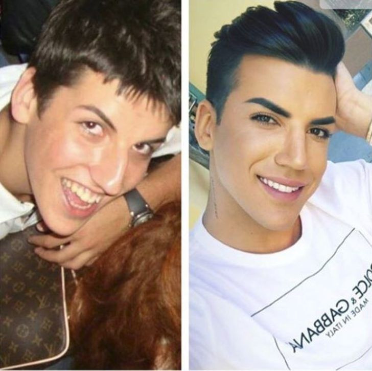 Yıllar önceki fotoğraflarını görenler tanıyamıyor! - Sayfa 31