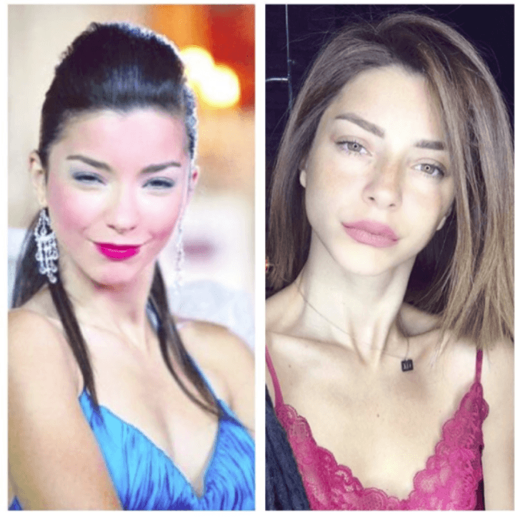 Yıllar önceki fotoğraflarını görenler tanıyamıyor! - Sayfa 7