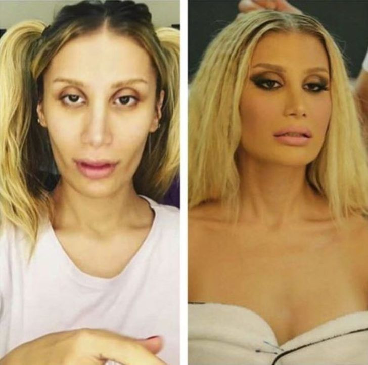 Yıllar önceki fotoğraflarını görenler tanıyamıyor! - Sayfa 10